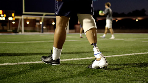 Soccer player's legs, one of which is prosthetic